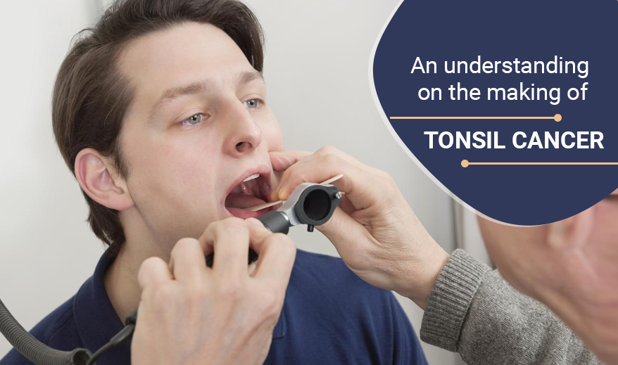 An understanding on the making of tonsil cancer